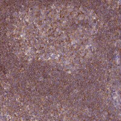 Immunohistochemistry-Paraffin: Protein Kinase A regulatory subunit I alpha Antibody [NBP2-33585]