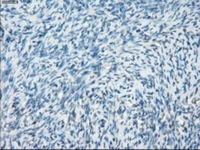 Immunohistochemistry: Protein Kinase A regulatory subunit I alpha Antibody (OTI6C7) - Azide and BSA Free [NBP2-73659]