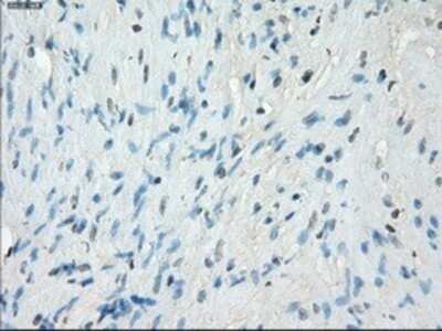 Immunohistochemistry: Protein Kinase A regulatory subunit I alpha Antibody (OTI6C7) - Azide and BSA Free [NBP2-73659]
