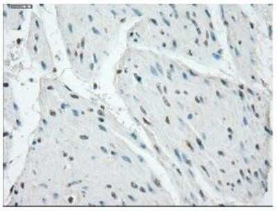 Immunohistochemistry: Protein Kinase A regulatory subunit I alpha Antibody (OTI6C7) - Azide and BSA Free [NBP2-73659]
