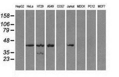 Western Blot: Protein Kinase A regulatory subunit I alpha Antibody (OTI6C7)Azide and BSA Free [NBP2-73659]