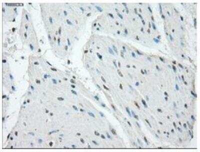 Immunohistochemistry-Paraffin: Protein Kinase A regulatory subunit I alpha Antibody (OTI6C7) [NBP1-47935]