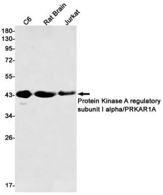 Western Blot: Protein Kinase A regulatory subunit I alpha Antibody (S06-8A5) [NBP3-15086]