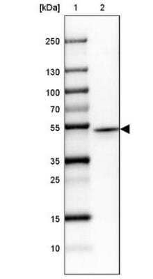 Western Blot: Protein Kinase A regulatory subunit I alpha Antibody [NBP2-33585]