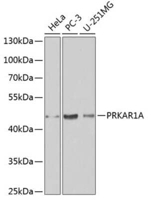 Western Blot: Protein Kinase A regulatory subunit I alpha AntibodyAzide and BSA Free [NBP2-93193]