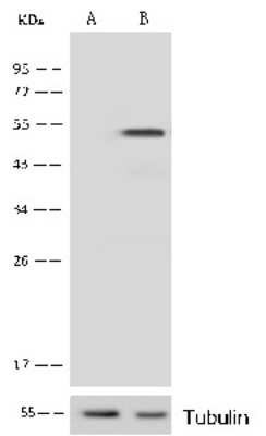 Western Blot: Protein Kinase A regulatory subunit I alpha Antibody [NBP3-00289]