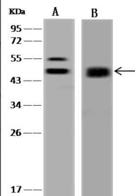 Western Blot: Protein Kinase A regulatory subunit I alpha Antibody [NBP3-06561]