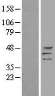 Western Blot: Protein Kinase A regulatory subunit I alpha Overexpression Lysate [NBL1-14765]