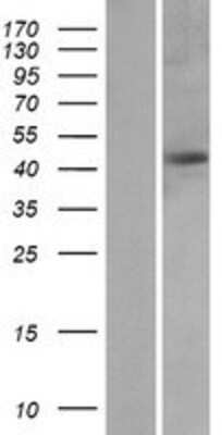 Western Blot: Protein Kinase A regulatory subunit I alpha Overexpression Lysate [NBP2-04233]