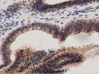 Immunohistochemistry-Paraffin: Protein Kinase D2 Antibody (OTI5G1) [NBP2-02984]