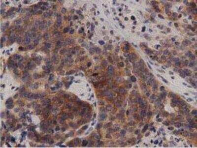 Immunohistochemistry-Paraffin: Protein Kinase D2 Antibody (OTI5G1) [NBP2-02984]