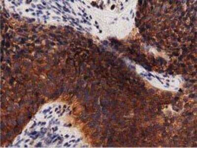 Immunohistochemistry-Paraffin: Protein Kinase D2 Antibody (OTI5G1) [NBP2-02984]