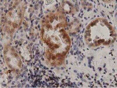 Immunohistochemistry-Paraffin: Protein Kinase D2 Antibody (OTI5G1) [NBP2-02984]