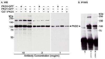 Immunoprecipitation: Protein Kinase D2 Antibody [NB100-636]