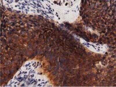 Immunohistochemistry: Protein Kinase D2 Antibody (OTI5G1) - Azide and BSA Free [NBP2-73664]