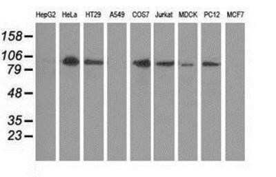 Western Blot: Protein Kinase D2 Antibody (OTI5G1)Azide and BSA Free [NBP2-73664]
