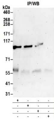 Western Blot: Protein Kinase D2 Antibody [NB100-636]