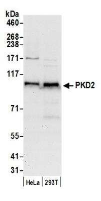 Western Blot: Protein Kinase D2 Antibody [NB100-636]