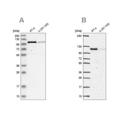 Western Blot: Protein Kinase D2 Antibody [NBP1-84139]