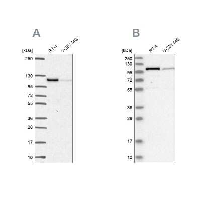 Western Blot: Protein Kinase D2 Antibody [NBP2-58315]