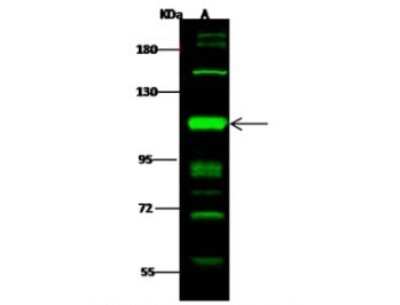 Western Blot: Protein Kinase D2 Antibody [NBP2-99858]