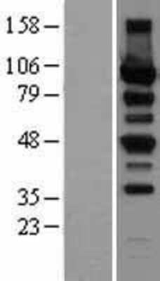 Western Blot: Protein Kinase D2 Overexpression Lysate [NBL1-14780]