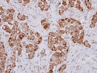 Immunohistochemistry-Paraffin: PRKD3/nPKC nu Antibody [NBP2-19958]