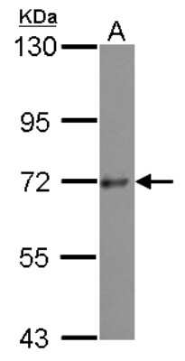 Western Blot: PRKD3/nPKC nu Antibody [NBP2-19958]