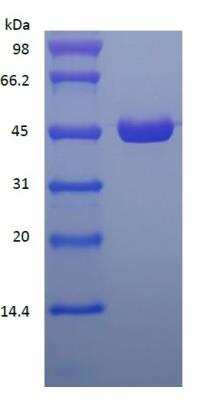 SDS-PAGE: Recombinant Protein L Type 1 Protein [NBP2-35049]