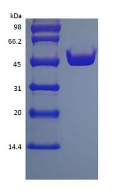 SDS-PAGE: Recombinant Protein L Type 1 His (N-Term) Protein [NBP2-35045]