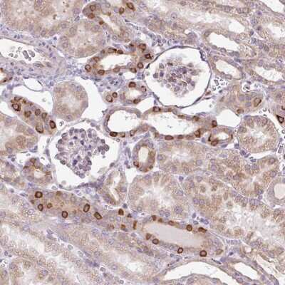 Immunohistochemistry: Protein O-Fucosyltransferase 1/POFUT1 Antibody [NBP2-49136]