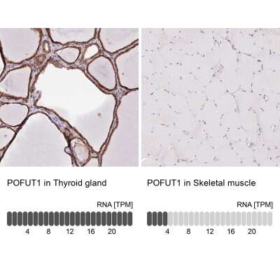 Immunohistochemistry-Paraffin: Protein O-Fucosyltransferase 1/POFUT1 Antibody [NBP2-49136]