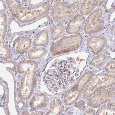 Immunohistochemistry-Paraffin: Protein O-Glucosyltransferase 1/POGLUT1/KTELC1 Antibody [NBP1-90311]