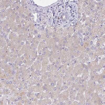 Immunohistochemistry-Paraffin: Protein O-Glucosyltransferase 1/POGLUT1/KTELC1 Antibody [NBP1-90311]