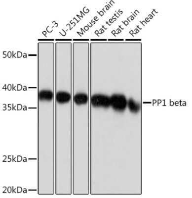 Western Blot: Protein Phosphatase 1 beta Antibody (5O9E7) [NBP3-16389]