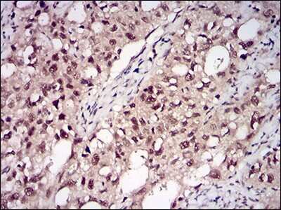Immunohistochemistry-Paraffin: Protein Phosphatase 1 beta Antibody (8A7C7) - BSA Free [NBP2-52539]