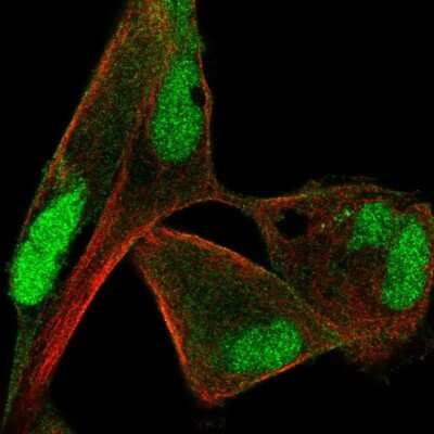Immunocytochemistry/ Immunofluorescence: Protein Phosphatase 1 beta Antibody [NBP2-49446]