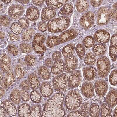 Immunohistochemistry: Protein Phosphatase 1 beta Antibody [NBP2-49446]