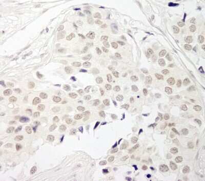 Immunohistochemistry-Paraffin: Protein Phosphatase 1 beta Antibody [NB110-40550]
