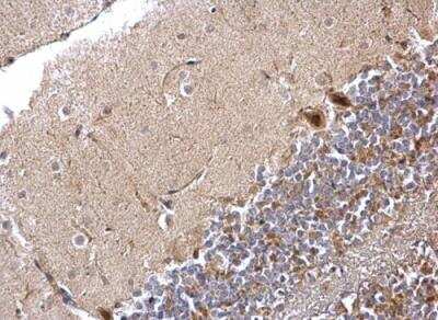 Immunohistochemistry-Paraffin: Protein Phosphatase 1 beta Antibody [NBP1-32618]