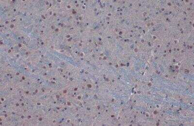 Immunohistochemistry-Paraffin: Protein Phosphatase 1 beta Antibody [NBP1-32618]