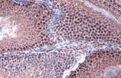 Immunohistochemistry-Paraffin: Protein Phosphatase 1 beta Antibody [NBP1-32618]