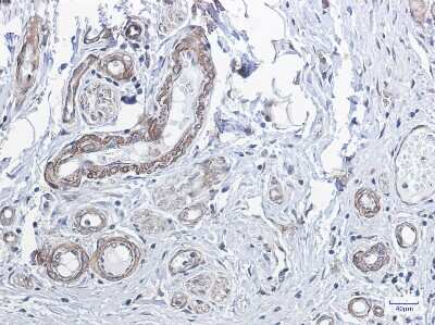 Immunohistochemistry-Paraffin: Protein Phosphatase 1 beta Antibody (S09-6B7) [NBP3-14965]