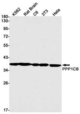 Western Blot: Protein Phosphatase 1 beta Antibody (S09-6B7) [NBP3-14965]