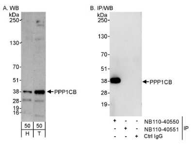 Western Blot: Protein Phosphatase 1 beta Antibody [NB110-40550]