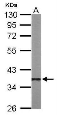 Western Blot: Protein Phosphatase 1 beta Antibody [NBP1-32618]