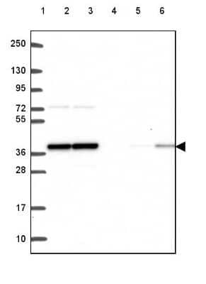 Western Blot: Protein Phosphatase 1 beta Antibody [NBP2-49446]