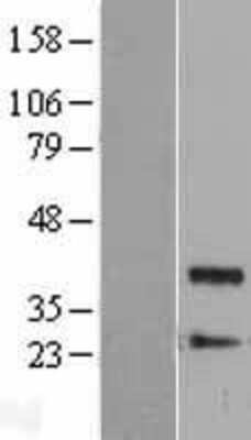 Western Blot: Protein Phosphatase 1 beta Overexpression Lysate [NBL1-14671]