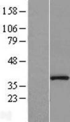 Western Blot: Protein Phosphatase 1 beta Overexpression Lysate [NBL1-14672]