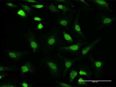 Immunocytochemistry/ Immunofluorescence: Protein Phosphatase 1C gamma Antibody [H00005501-B02P]
